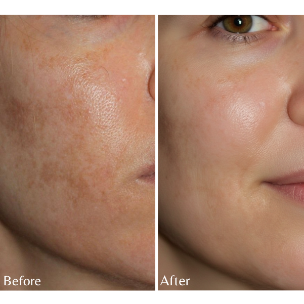 Facial serum for reducing dark spots and improving skin brightness