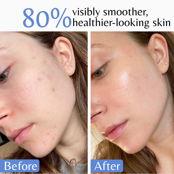 deeply-nourished-healthy-skin
Illustration highlighting deeply nourished, healthy-looking skin with lasting hydration and softness.