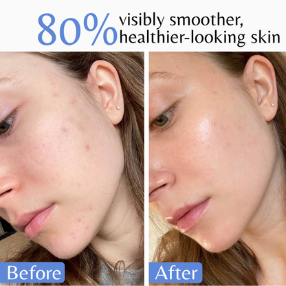 deeply-nourished-healthy-skin
Illustration highlighting deeply nourished, healthy-looking skin with lasting hydration and softness.