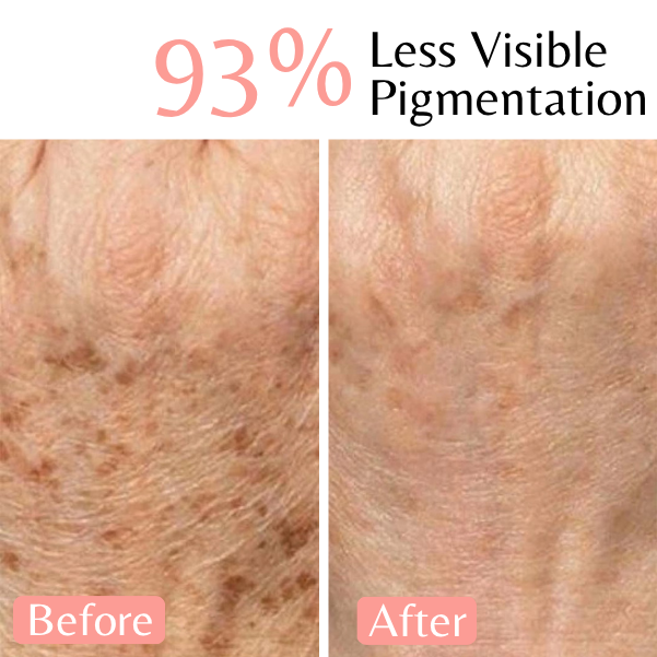 Emilia Lux Dark Spot Correction Duo for less visible pigmentation and a brighter, more even-looking complexion.