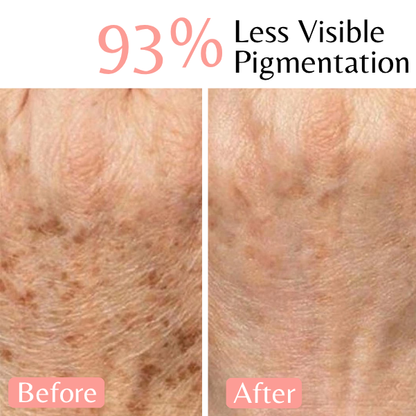 Emilia Lux Dark Spot Correction Duo for less visible pigmentation and a brighter, more even-looking complexion.