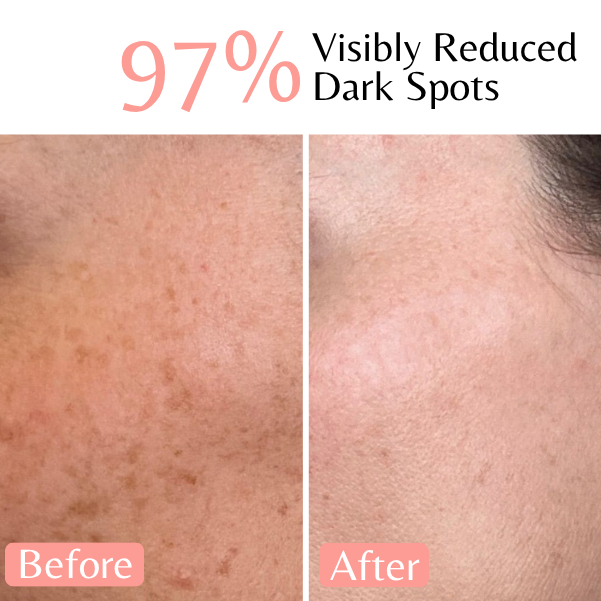 Emilia Lux Dark Spot Correction Duo – 97% visibly reduced dark spots for a clearer, more even-looking complexion.