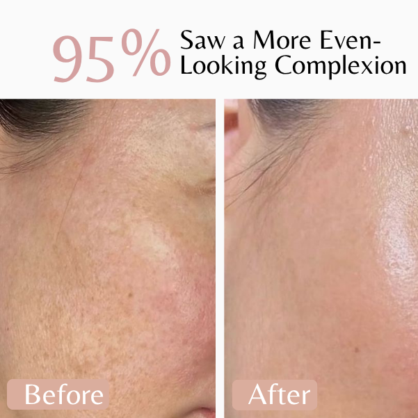 Emilia Lux Pigment Control Serum for a brighter, more even-looking complexion