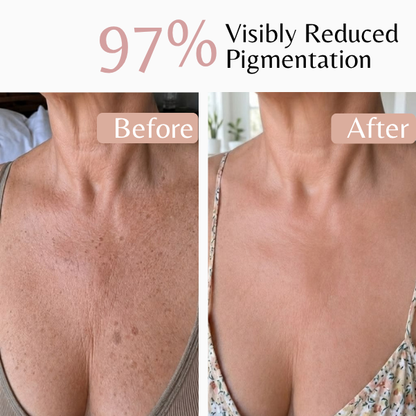 Emilia Lux Pigment Control Serum for visibly reduced pigmentation and a more even-looking complexion