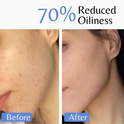 Before and after comparison showing visibly reduced oiliness and a more balanced complexion after using Emilia Lux Purifying Mousse.