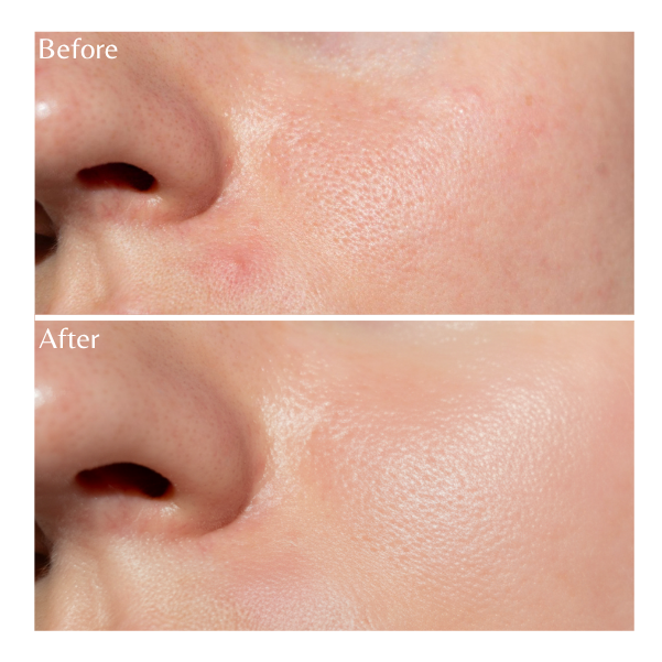 Emilia Lux Purifying Mousse Foaming Face Wash – gentle facial cleanser that deeply cleanses pores and removes excess oil while maintaining hydrated, balanced skin