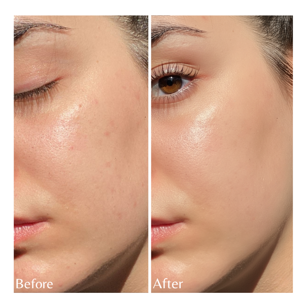 Vitamin C serum designed to brighten dull and tired-looking skin