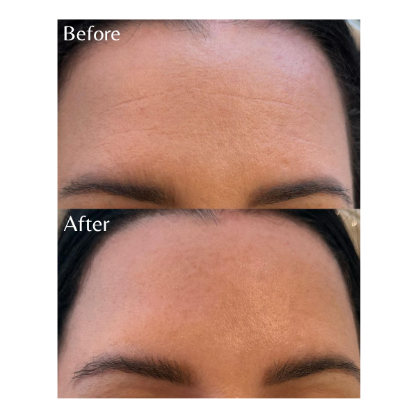Wrinkle repair face cream for visible fine lines and firmer skin